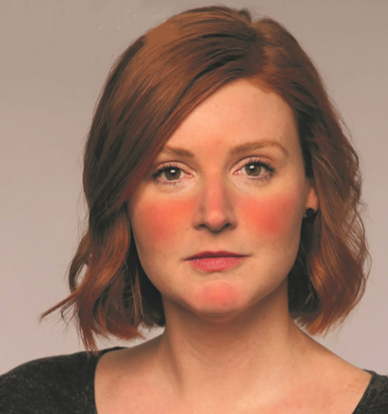 إليكم 11 طريقة للتخلص من مشكلة احمرار الوجه في المواقف المحرجة! صورة رقم 10 إليكم 11 طريقة للتخلص من مشكلة احمرار الوجه في المواقف المحرجة! صورة رقم 10