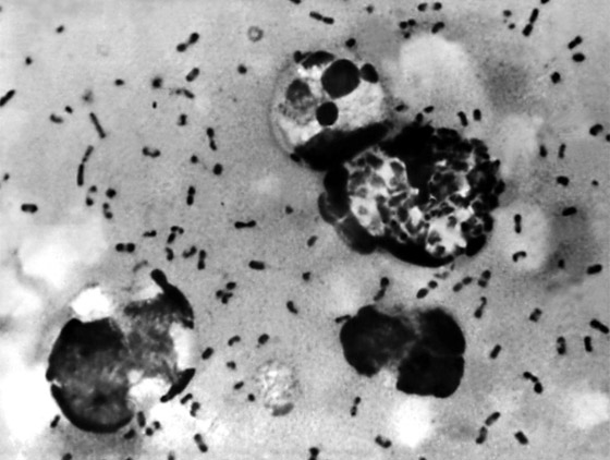 بعد كورونا وإنفلونزا الخنازير.. تحذير من تفشي الطاعون الأسود القادم! صورة رقم 3 بعد كورونا وإنفلونزا الخنازير.. تحذير من تفشي الطاعون الأسود القادم! صورة رقم 3