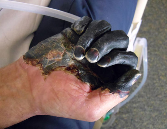 بعد كورونا وإنفلونزا الخنازير.. تحذير من تفشي الطاعون الأسود القادم! صورة رقم 10 بعد كورونا وإنفلونزا الخنازير.. تحذير من تفشي الطاعون الأسود القادم! صورة رقم 10