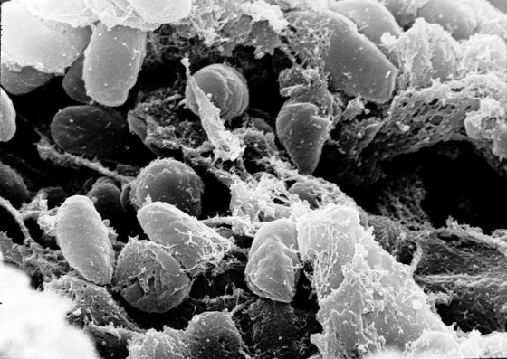 بعد كورونا وإنفلونزا الخنازير.. تحذير من تفشي الطاعون الأسود القادم! صورة رقم 14 بعد كورونا وإنفلونزا الخنازير.. تحذير من تفشي الطاعون الأسود القادم! صورة رقم 14