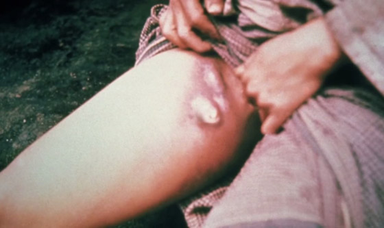 بعد كورونا وإنفلونزا الخنازير.. تحذير من تفشي الطاعون الأسود القادم! صورة رقم 4 بعد كورونا وإنفلونزا الخنازير.. تحذير من تفشي الطاعون الأسود القادم! صورة رقم 4