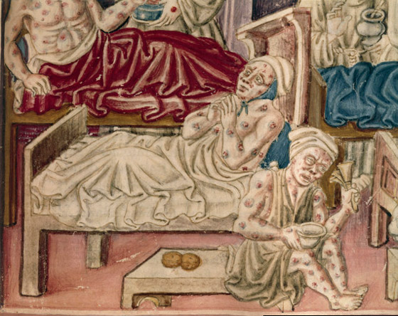 بعد كورونا وإنفلونزا الخنازير.. تحذير من تفشي الطاعون الأسود القادم! صورة رقم 5 بعد كورونا وإنفلونزا الخنازير.. تحذير من تفشي الطاعون الأسود القادم! صورة رقم 5