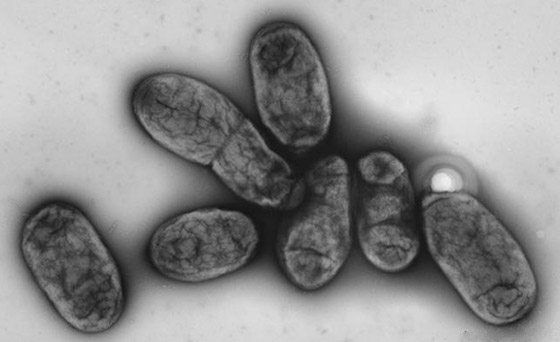 بعد كورونا وإنفلونزا الخنازير.. تحذير من تفشي الطاعون الأسود القادم! صورة رقم 2 بعد كورونا وإنفلونزا الخنازير.. تحذير من تفشي الطاعون الأسود القادم! صورة رقم 2