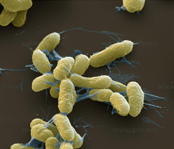 بعد كورونا وإنفلونزا الخنازير.. تحذير من تفشي الطاعون الأسود القادم! صورة رقم 17 بعد كورونا وإنفلونزا الخنازير.. تحذير من تفشي الطاعون الأسود القادم! صورة رقم 17