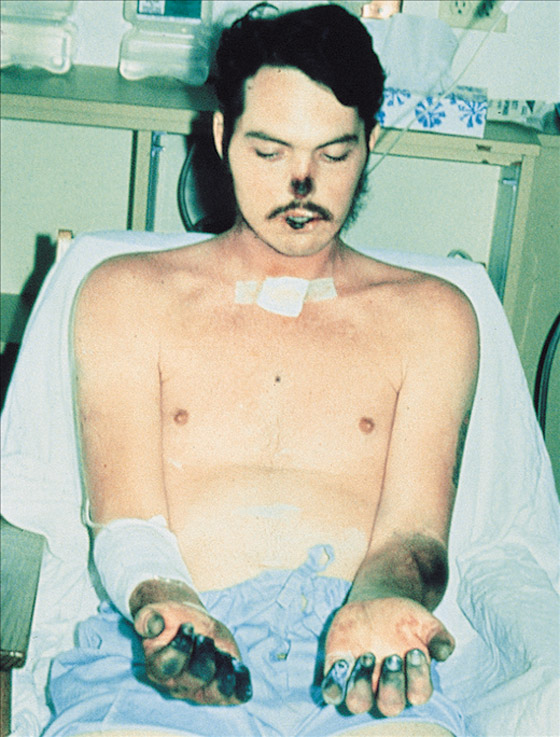 بعد كورونا وإنفلونزا الخنازير.. تحذير من تفشي الطاعون الأسود القادم! صورة رقم 19 بعد كورونا وإنفلونزا الخنازير.. تحذير من تفشي الطاعون الأسود القادم! صورة رقم 19