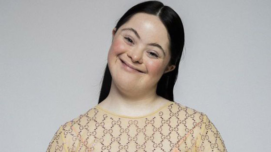 لأول مرة عارضة أزياء بمتلازمة داون تظهر على صفحات مجلة فوغ صورة رقم 6