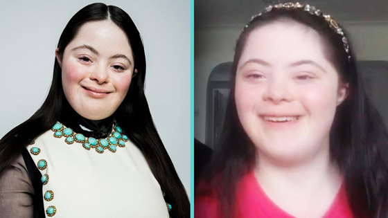 لأول مرة عارضة أزياء بمتلازمة داون تظهر على صفحات مجلة فوغ صورة رقم 8