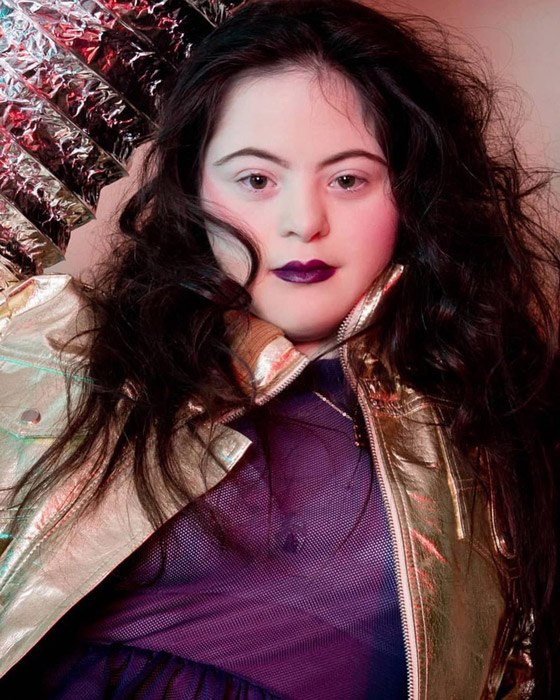 لأول مرة عارضة أزياء بمتلازمة داون تظهر على صفحات مجلة فوغ صورة رقم 2