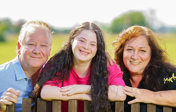 لأول مرة عارضة أزياء بمتلازمة داون تظهر على صفحات مجلة فوغ صورة رقم 5