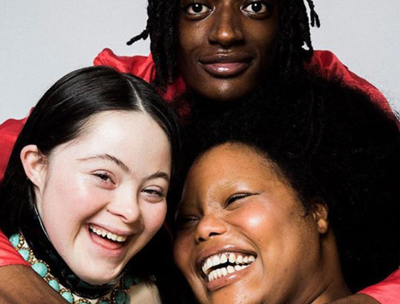 لأول مرة عارضة أزياء بمتلازمة داون تظهر على صفحات مجلة فوغ صورة رقم 9