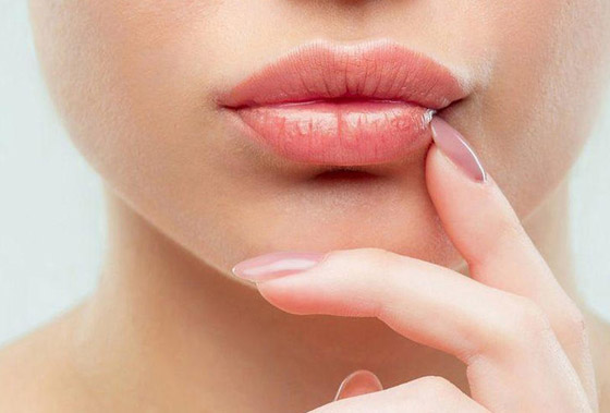 الشفاه تعطي 8 إشارات تحذر من مشكلات صحية خطيرة في الجسم صورة رقم 1