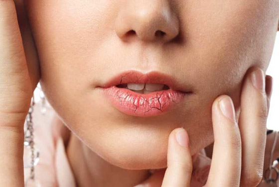 الشفاه تعطي 8 إشارات تحذر من مشكلات صحية خطيرة في الجسم صورة رقم 8 الشفاه تعطي 8 إشارات تحذر من مشكلات صحية خطيرة في الجسم صورة رقم 8