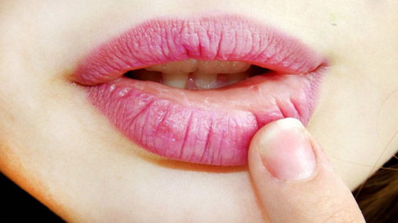إليكم 4 أسباب خفية وراء تشقق الشفاه.. قد يكون السبب معجون الأسنان! صورة رقم 6