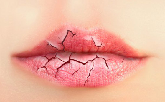 إليكم 4 أسباب خفية وراء تشقق الشفاه.. قد يكون السبب معجون الأسنان! صورة رقم 3