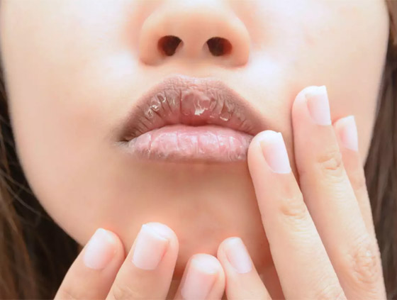 إليكم 4 أسباب خفية وراء تشقق الشفاه.. قد يكون السبب معجون الأسنان! صورة رقم 5