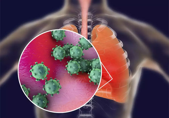 بخطورة متفاوتة.. علماء يحددُون 6 أنواع من إصابات كورونا صورة رقم 1