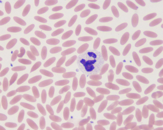 أمل يلوح من الإبل.. دم حيوان اللاما علاج محتمل لوباء كورونا صورة رقم 11