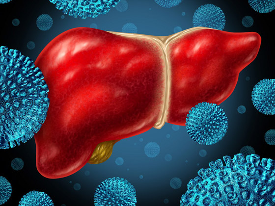 إليك كل ما تريد معرفته عن التهاب الكبد وأنواعه وأسبابه وأعراضه! صورة رقم 7