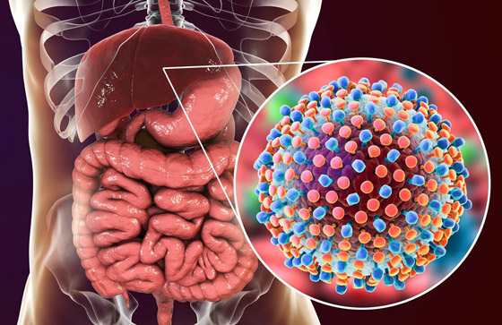 إليك كل ما تريد معرفته عن التهاب الكبد وأنواعه وأسبابه وأعراضه! صورة رقم 3
