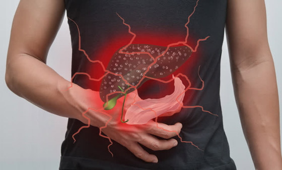 إليك كل ما تريد معرفته عن التهاب الكبد وأنواعه وأسبابه وأعراضه! صورة رقم 10