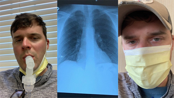 أضرار دائمة! رسالة تحذيرية من شباب ناجين من كورونا لا يزالون يعانون صورة رقم 6