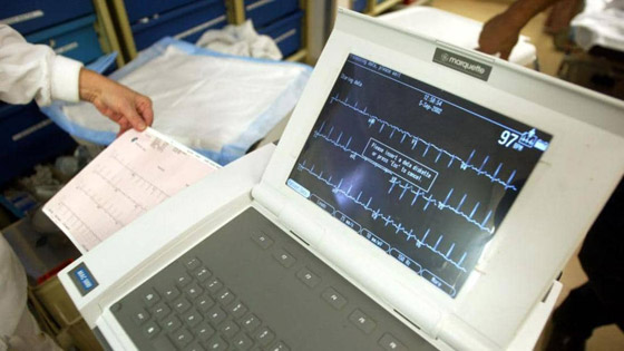 بسبب فيروس كورونا.. النوبات القلبية أصبحت أكثر فتكا! صورة رقم 2