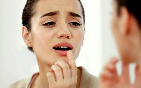 إليكم طريقة ترطيب الشفاه الجافة طبيعيا بخلطة مدهشة من صنع يديكم صورة رقم 1