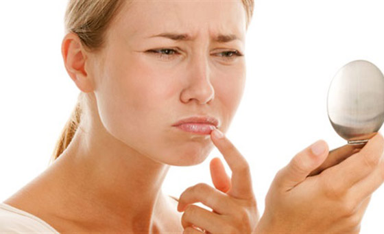 إليكم طريقة ترطيب الشفاه الجافة طبيعيا بخلطة مدهشة من صنع يديكم صورة رقم 3