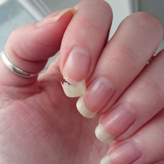 كيف تصلحين الظفر المكسور؟ الخبراء يقدمون لكِ 3 حلول..! صورة رقم 4