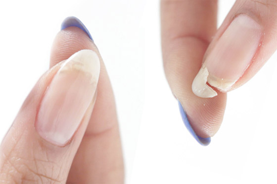 كيف تصلحين الظفر المكسور؟ الخبراء يقدمون لكِ 3 حلول..! صورة رقم 6