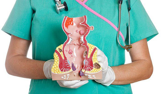 مرض مزعج بأعراضه.. البواسير: أنواعها وطرق علاجها بالأعشاب صورة رقم 6