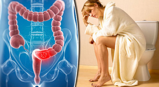 مرض مزعج بأعراضه.. البواسير: أنواعها وطرق علاجها بالأعشاب صورة رقم 4