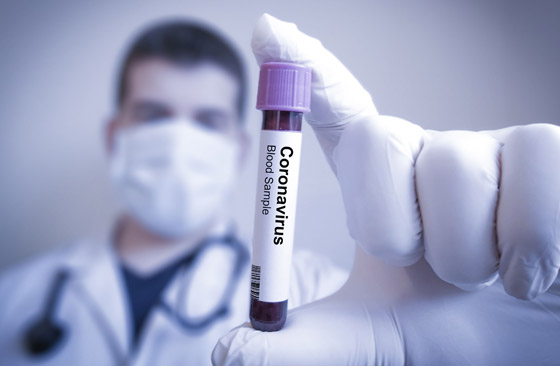 الوضع خطير: تشديدات عالمية وإغلاق خوفا من الموجة الثانية لكورونا! صورة رقم 10