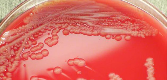 حقائق هامة عن بكتيريا الدم والأشخاص الأكثر عرضه بالإصابه به صورة رقم 3