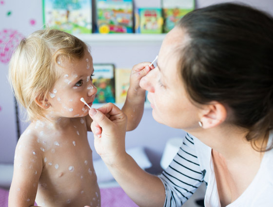 تعرفوا على تاريخ الموجة الثانية العنيفة من الأوبئة الأشد فتكا بالبشرية صورة رقم 5 تعرفوا على تاريخ الموجة الثانية العنيفة من الأوبئة الأشد فتكا بالبشرية صورة رقم 5