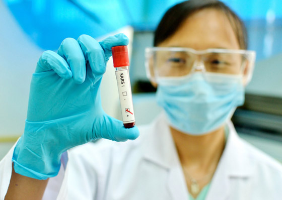 تعرفوا على تاريخ الموجة الثانية العنيفة من الأوبئة الأشد فتكا بالبشرية صورة رقم 6 تعرفوا على تاريخ الموجة الثانية العنيفة من الأوبئة الأشد فتكا بالبشرية صورة رقم 6