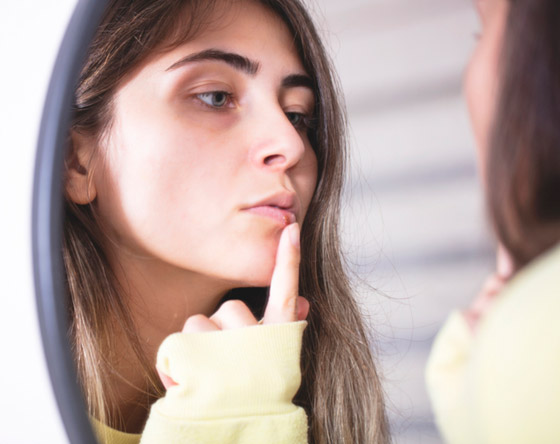 هكذا تعالجون قروح البرد أو بثور الحمى بطرق طبيعية صورة رقم 2