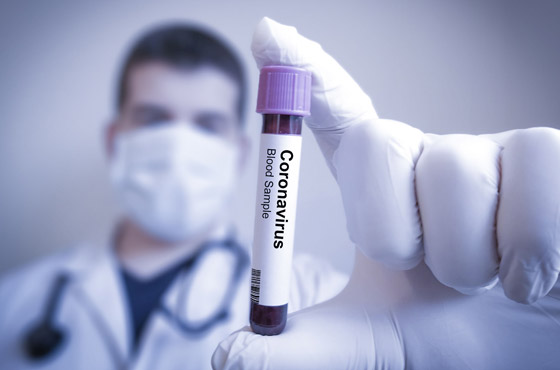 وباء فيروس كورونا.. الإصابات نحو 29 مليونا والوفيات قريب المليون صورة رقم 4