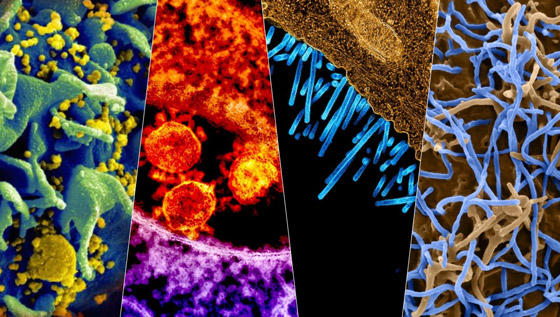 انتشار فيروس جديد في الصين بسبب تسرب من مختبر اللقاحات! صورة رقم 5