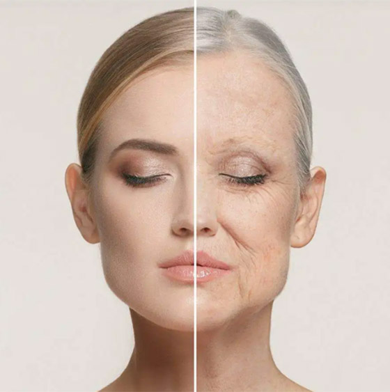 6 أخطاء شائعة وعادات خاطئة تؤدي إلى ظهور التجاعيد صورة رقم 7 6 أخطاء شائعة وعادات خاطئة تؤدي إلى ظهور التجاعيد صورة رقم 7