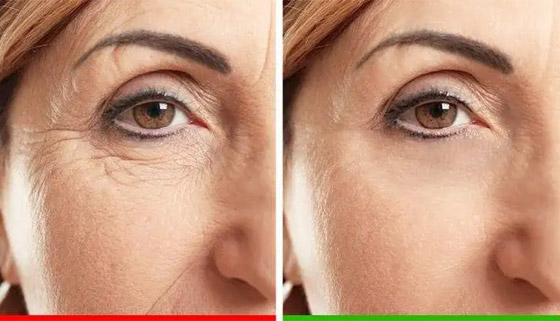 6 أخطاء شائعة وعادات خاطئة تؤدي إلى ظهور التجاعيد صورة رقم 2 6 أخطاء شائعة وعادات خاطئة تؤدي إلى ظهور التجاعيد صورة رقم 2