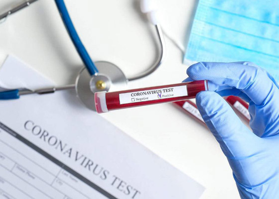 وفاة كل 16 ثانية.. ماذا يفعل فيروس كورونا الآن بالكرة الأرضية؟ صورة رقم 2 وفاة كل 16 ثانية.. ماذا يفعل فيروس كورونا الآن بالكرة الأرضية؟ صورة رقم 2