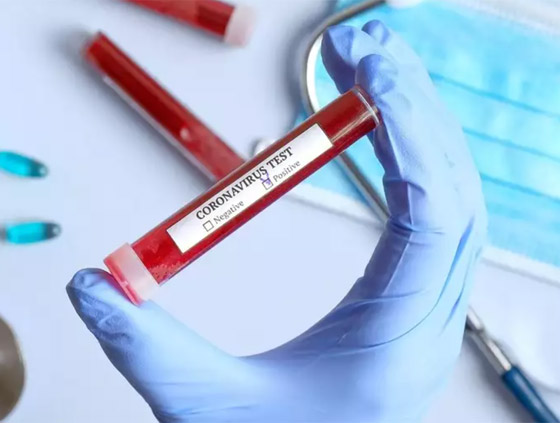 وفاة كل 16 ثانية.. ماذا يفعل فيروس كورونا الآن بالكرة الأرضية؟ صورة رقم 20 وفاة كل 16 ثانية.. ماذا يفعل فيروس كورونا الآن بالكرة الأرضية؟ صورة رقم 20