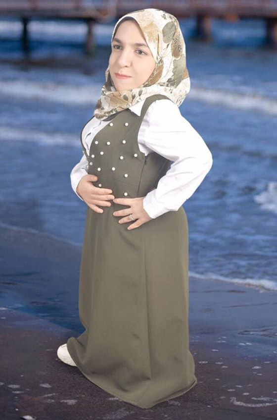 صور: أول عارضة أزياء مصرية قصيرة القامة تعرض تصاميمها المميزة صورة رقم 9