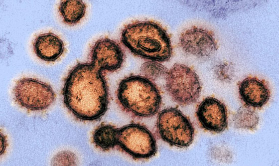 دراسة جديدة صادمة تكشف مدة بقاء كورونا على أسطح الأموال والزجاج! صورة رقم 2