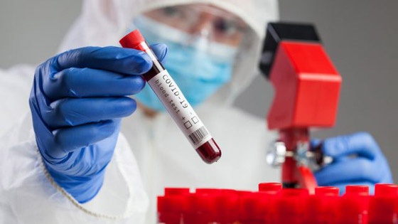 شاب يصاب بفيروس كورونا مرتين والعدوى الثانية أكثر وأشد خطورة! صورة رقم 5 شاب يصاب بفيروس كورونا مرتين والعدوى الثانية أكثر وأشد خطورة! صورة رقم 5