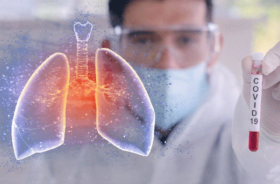 علماء أكسفورد يطورون اختبارا سريعا لكورونا تظهر نتائجه بأقل من 5 دقائق صورة رقم 3