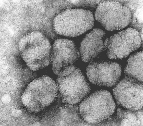 الجدري: المرض الفتاك الذي قتل الملايين وأدى لظهور أول لقاح في العالم صورة رقم 9