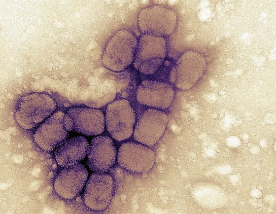 الجدري: المرض الفتاك الذي قتل الملايين وأدى لظهور أول لقاح في العالم صورة رقم 2