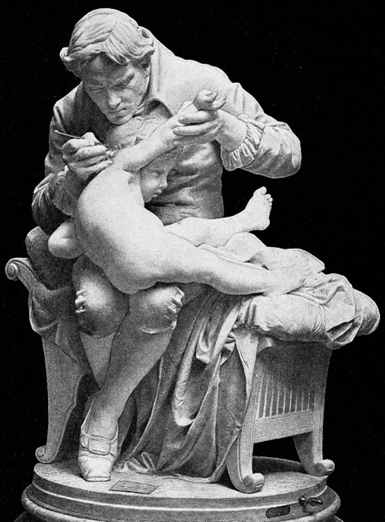 الجدري: المرض الفتاك الذي قتل الملايين وأدى لظهور أول لقاح في العالم صورة رقم 3